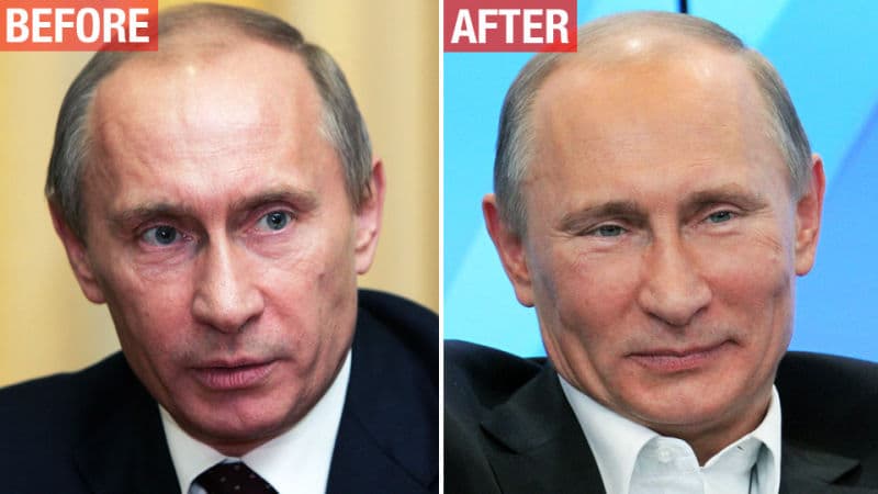 Putin Before After Plastic Surgery 1