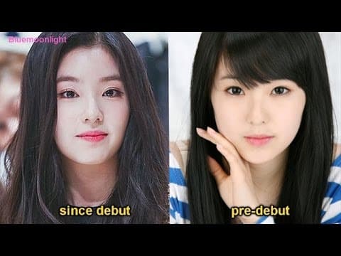 Red Velvet Plastic Surgery Before After 1