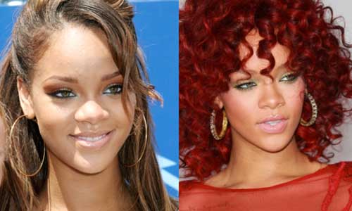 Stars With The Best Plastic Surgery Before And After 1