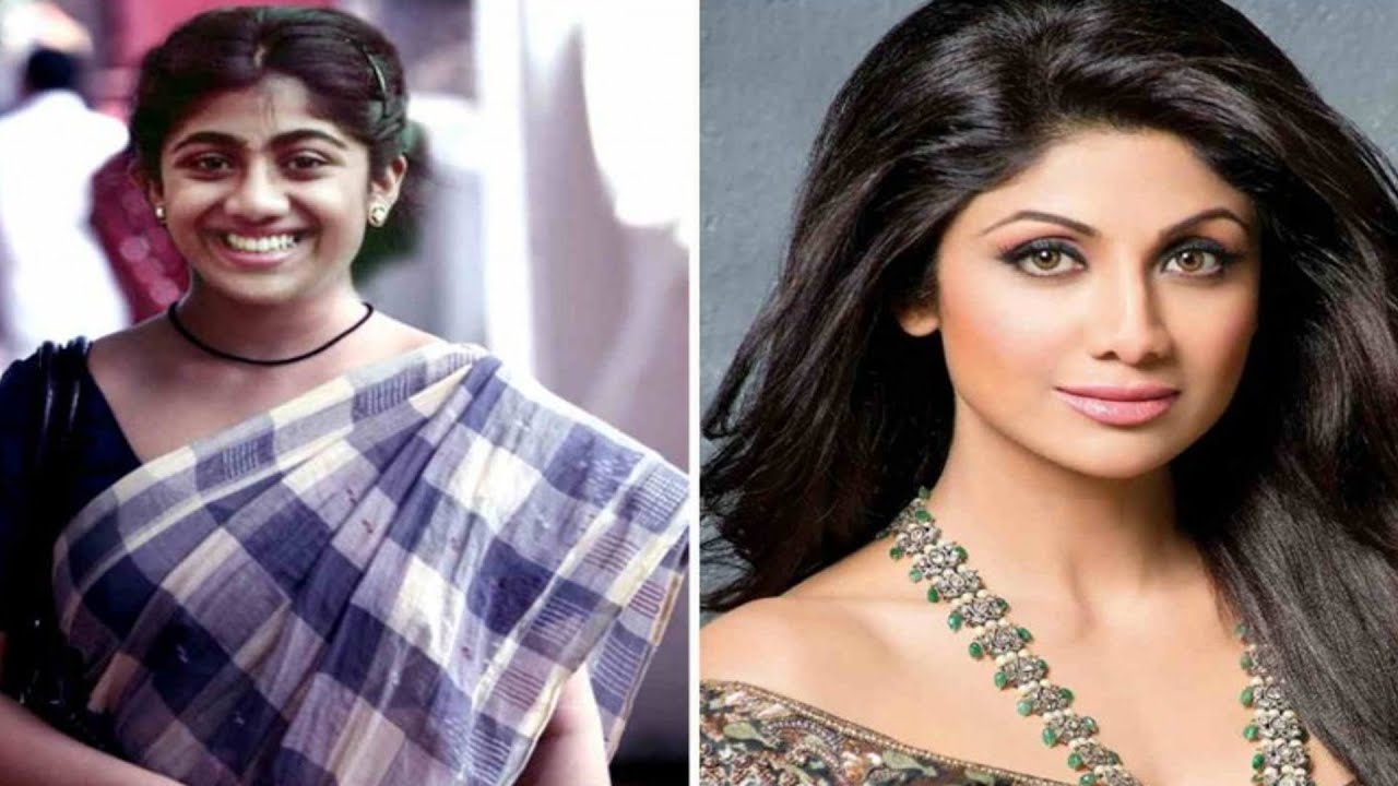 Bollywood Actresses Plastic Surgery Before And After Pics 1