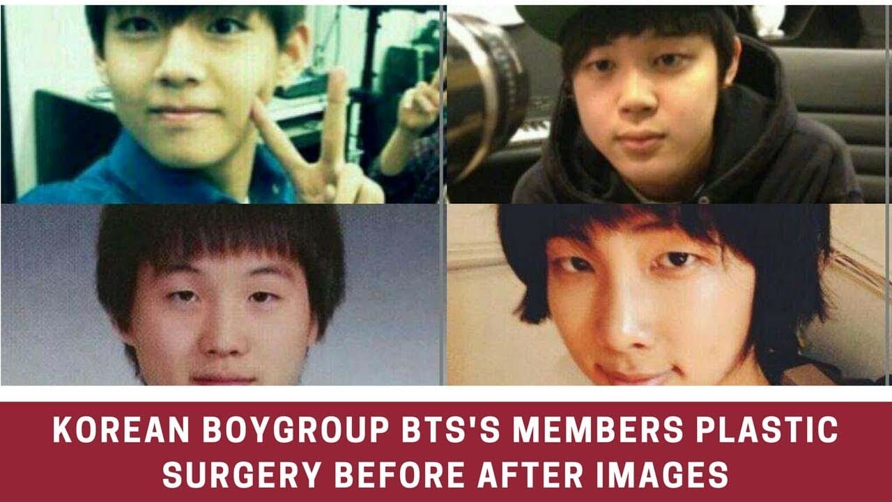 Bts Members Plastic Surgery Before And After 1