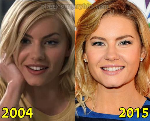 Elisha Cuthbert Before And After Plastic Surgery 1