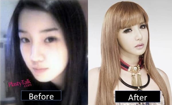 Nana Korean Before Plastic Surgery 1