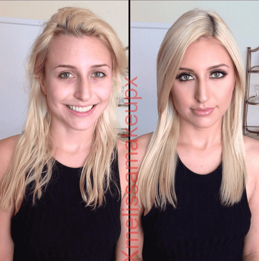 Phoenix Marie Before And After Plastic Surgery 1