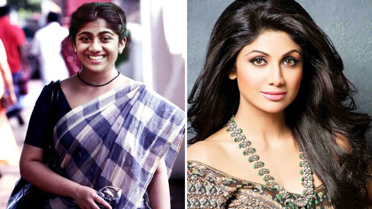 Plastic Surgery Before And After Bollywood Actress