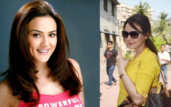 Preity Zinta Before After Plastic Surgery 1
