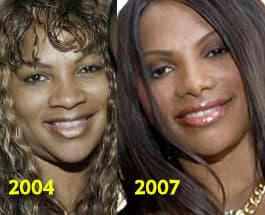 Salt N Pepa Before And After Plastic Surgery 1