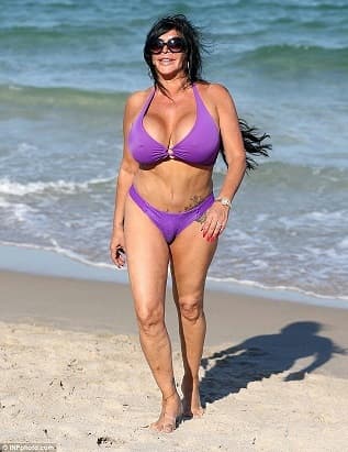 Angela Raiola Plastic Surgery Before And After photo - 1