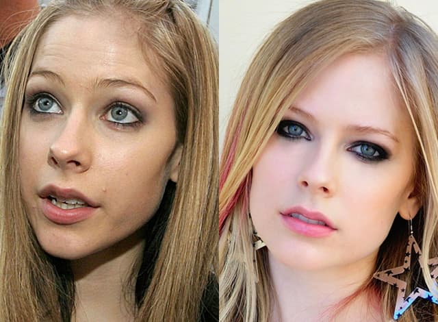 Avril Lavigne Before After Plastic Surgery photo - 1