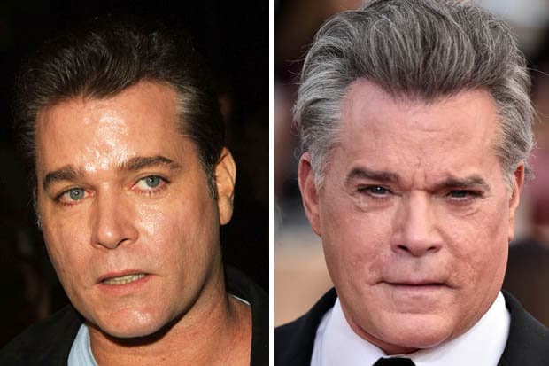 Before And After Plastic Surgery Ray Liotta photo - 1