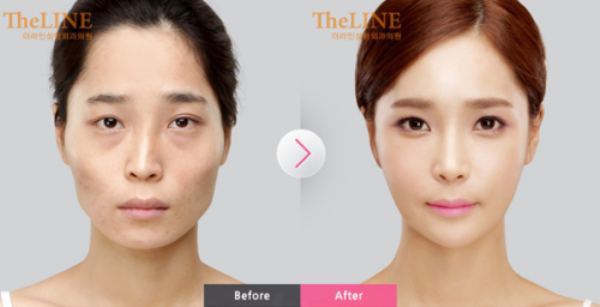 Before And After: Plastic Surgery Clinic photo - 1