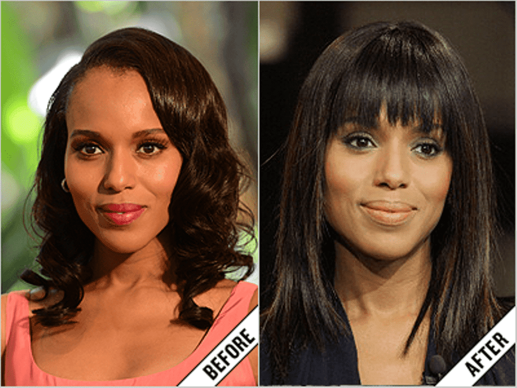 Black Celebrities Before And After Plastic Surgery photo - 1