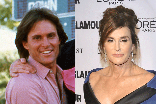 Bruce Jenner Before And After Plastic Surgery Pics photo - 1