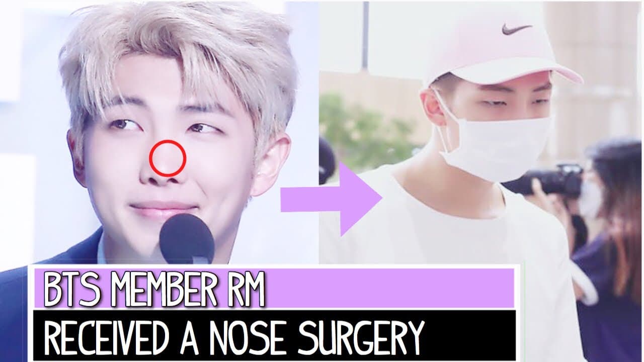 Bts Before And After Plastic Surgery photo - 1
