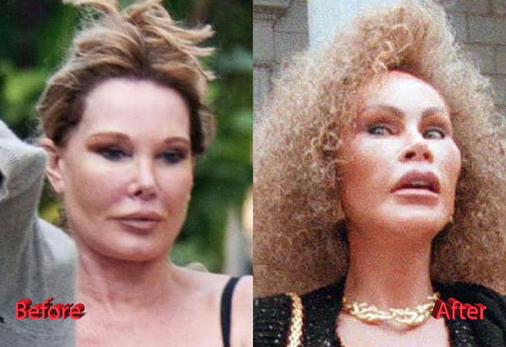 Cat Woman Face Before And After Plastic Surgery photo - 1