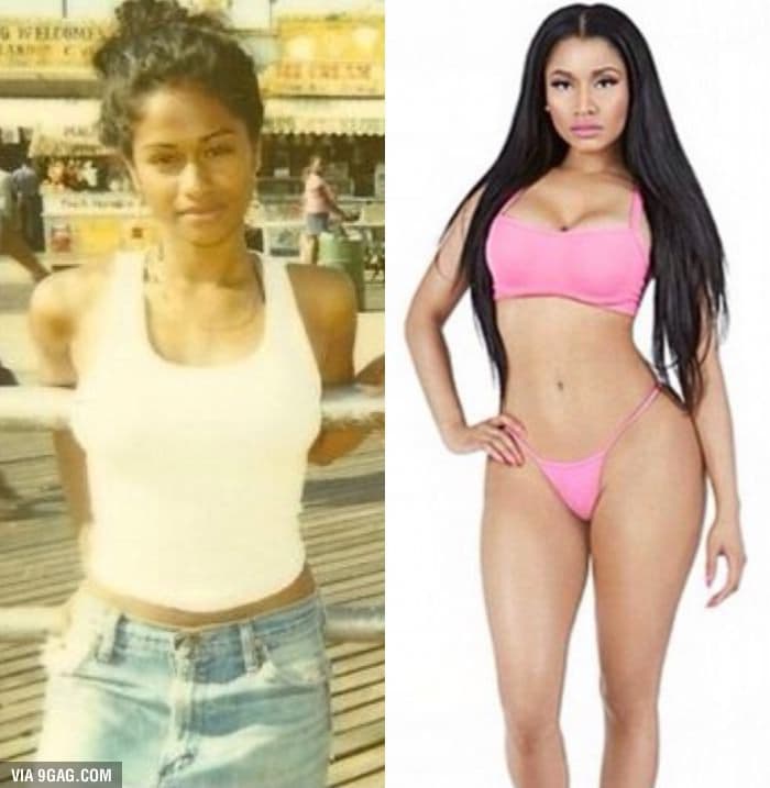 Colombian Women Before Plastic Surgery After photo - 1