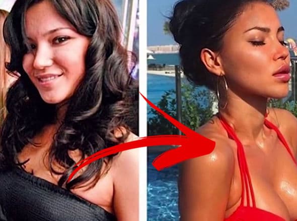 Hot Instagrams Before Plastic Surgery photo - 1