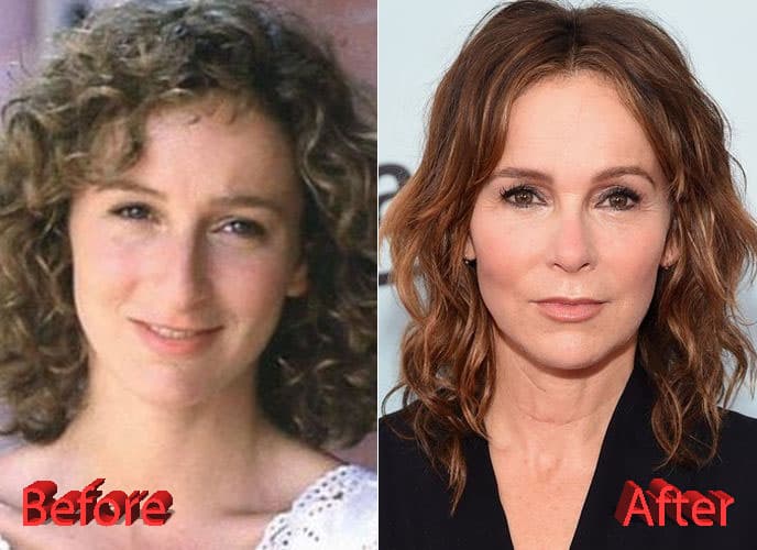 Jennifer Gray Before And After Plastic Surgery photo - 1