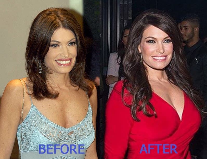 Jessica Tarlov Plastic Surgery Before And After Pictures photo - 1
