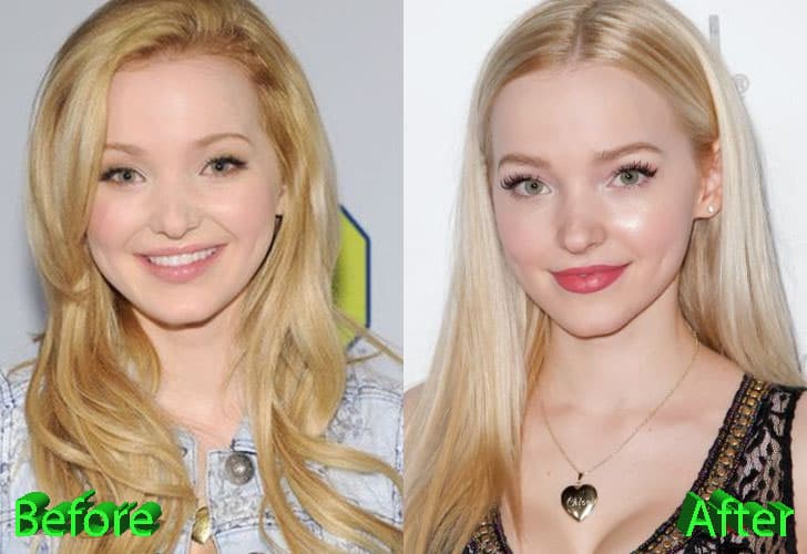 Jessie Before After Plastic Surgery photo - 1