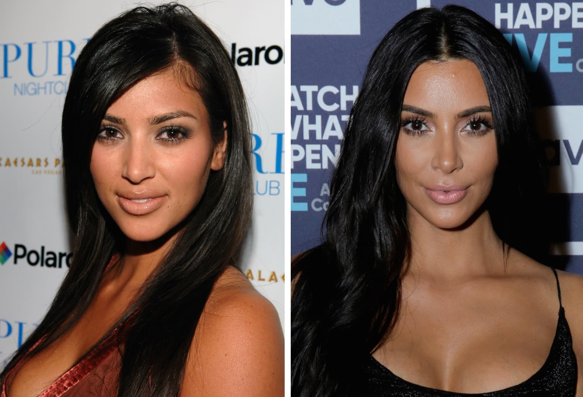 Kim Kardashians Face Before And After Plastic Surgery photo - 1