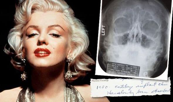 Marilyn Monroe Before Plastic Surgery photo - 1