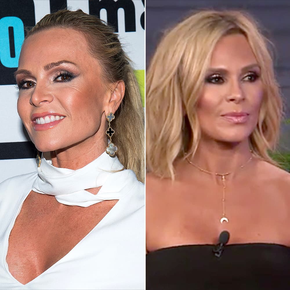 Real Housewives Orange County Plastic Surgery Before And After photo - 1