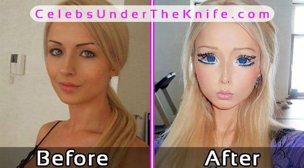 Real Life Barbie Plastic Surgery Before And After photo - 1