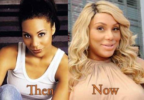 Toni Braxton Before And After Plastic Surgery photo - 1