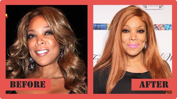Wendy Williams Before Plastic Surgery photo - 1