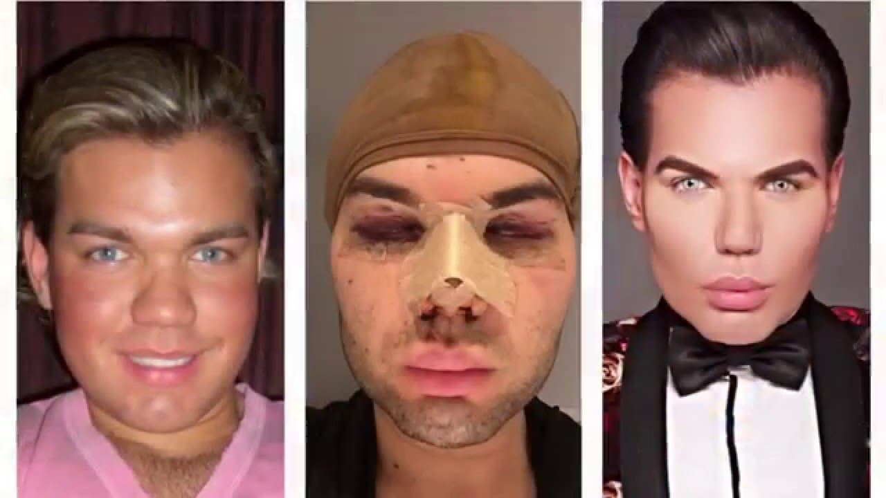 What Did The Human Ken Doll Look Like Before Plastic Surgery photo - 1