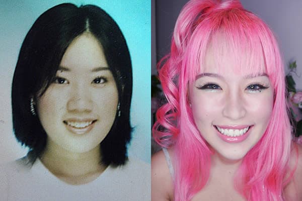 Xiaxue Before Plastic Surgery photo - 1