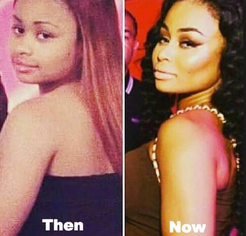 Blac Chyna Before And After Plastic Surgery Pictures 1