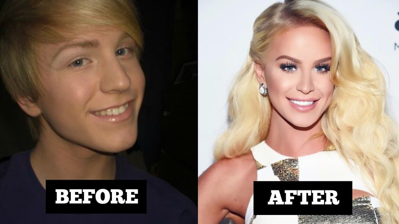 gender reassignment plastic surgery