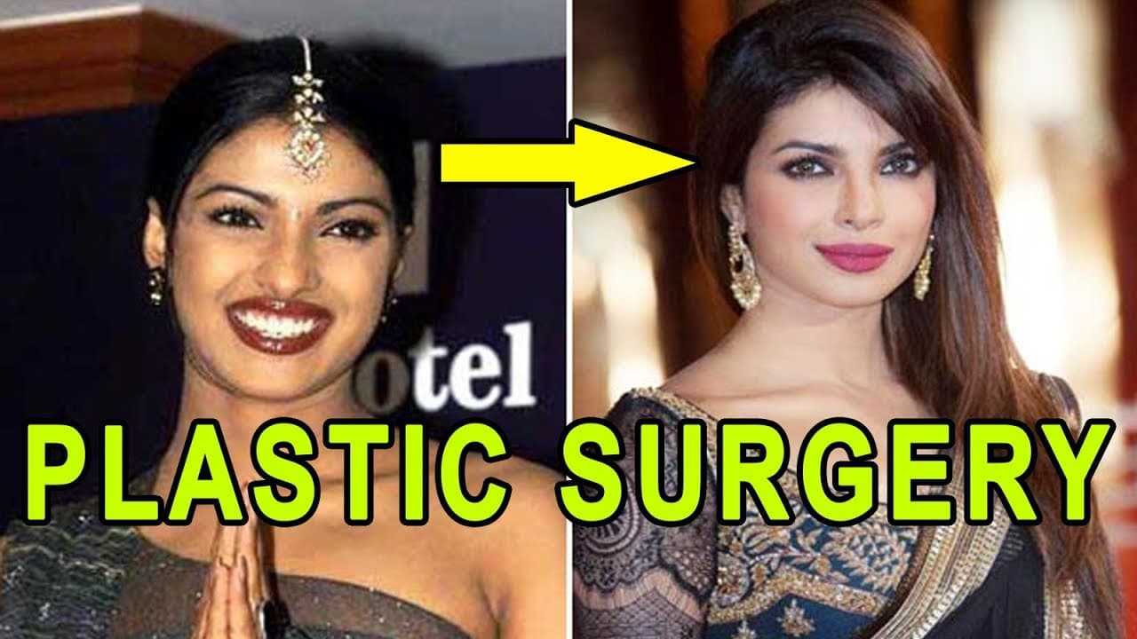 Actors Before And After Plastic Surgery 1
