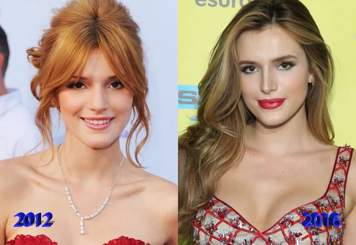 Bella Thorne Plastic Surgery Before And After 1