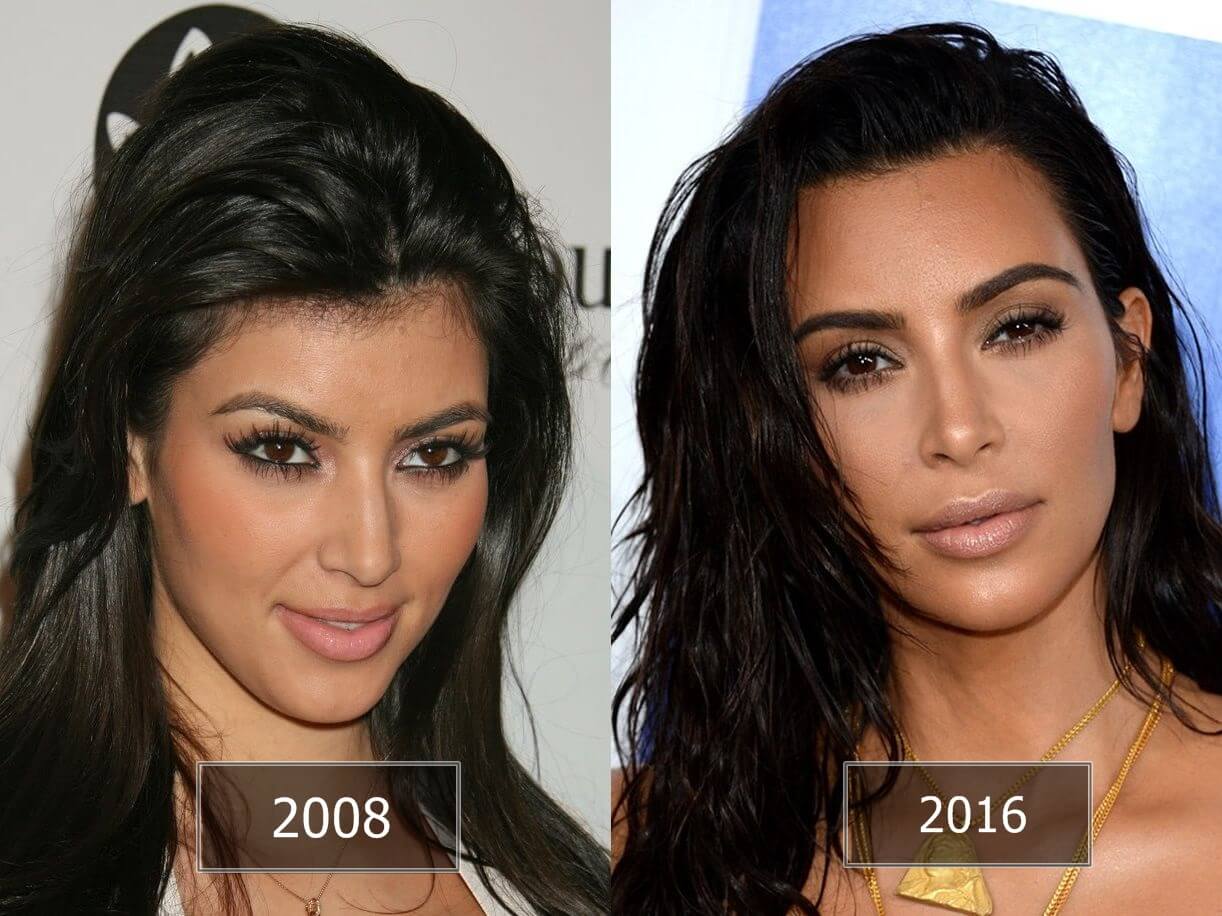 Pictures Of Kim Kardashian Before And After Plastic Surgery 1