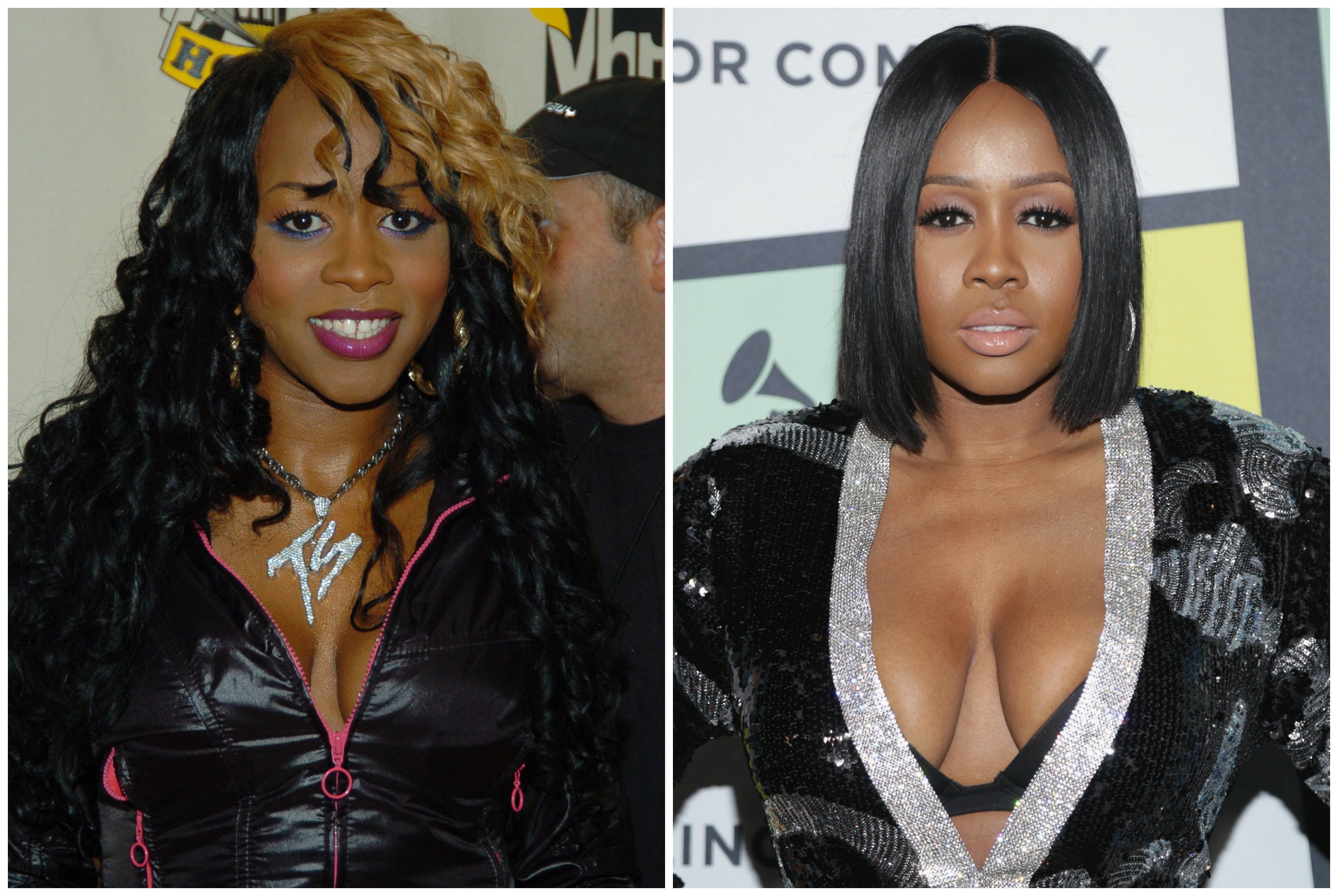 Remy Ma Before And After Plastic Surgery