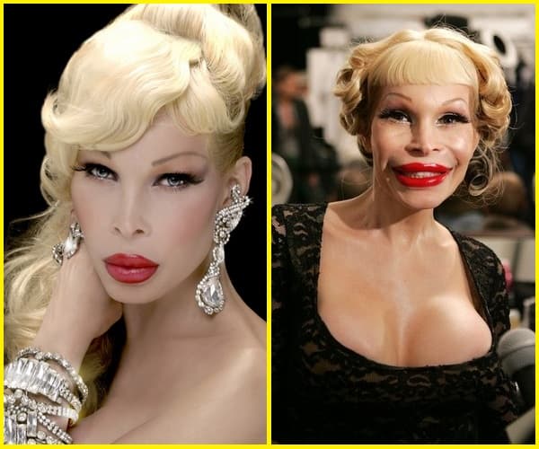 Amanda Lepore Before And After Plastic Surgery 1