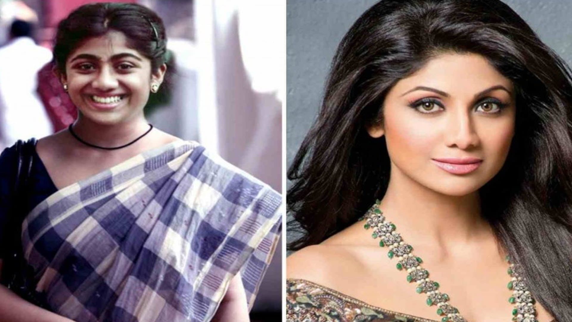 Bollywood Male Actors Plastic Surgery Before And After 1
