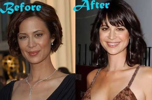 Catherine Bell Before And After Plastic Surgery 1