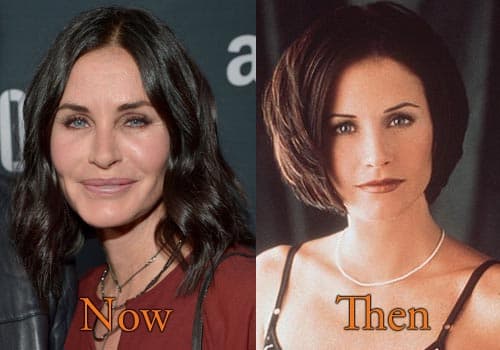 Courtney Cox Plastic Surgery Before And After 1