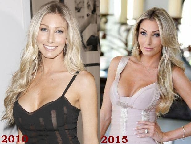 Heather From Million Dollar Listing Plastic Surgery Before And After 1