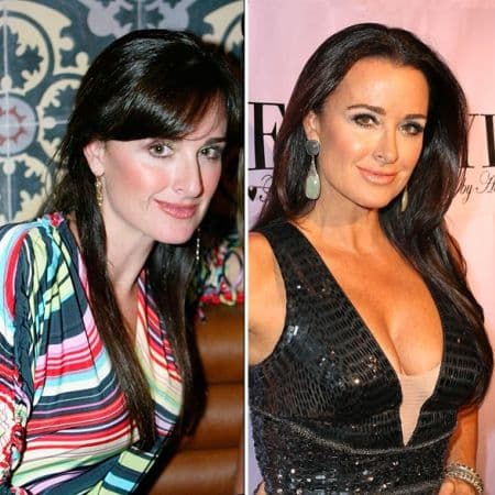 Kyle Richards Before And After Plastic Surgery 1