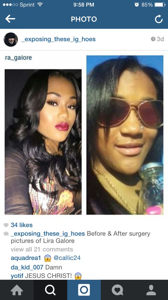Lira Galore Before And After Plastic Surgery 1