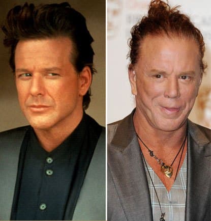 Mickey Rourke Before And After Plastic Surgery Pictures 1