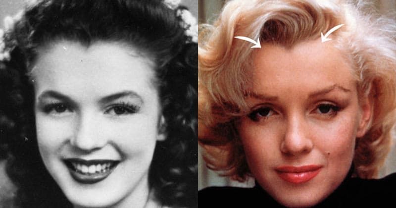 Movie Stars Before And After Plastic Surgery 1