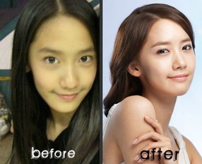 Sung Yuri Before Plastic Surgery 1