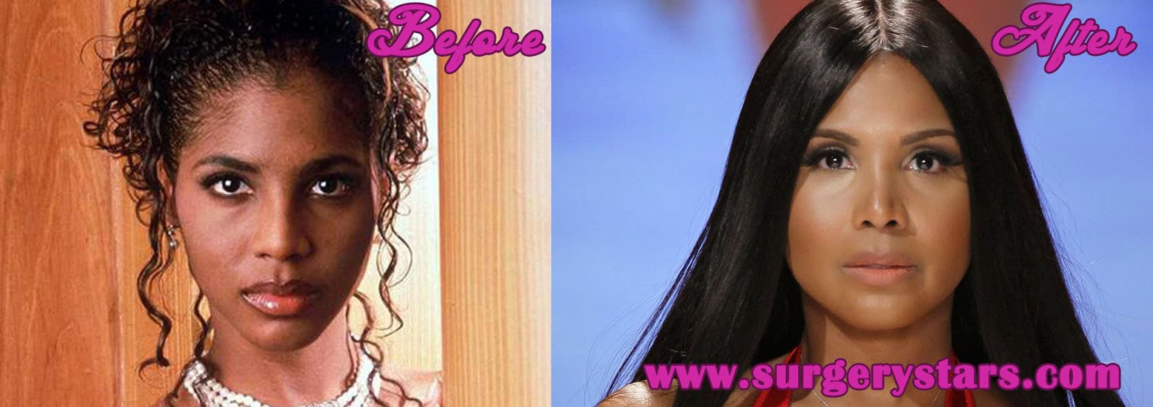 Toni Braxton Plastic Surgery Before And After 1
