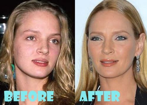 Uma Thurman Plastic Surgery Before And After 1